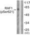 Raf-1 Proto-Oncogene, Serine/Threonine Kinase antibody, TA313056, Origene, Western Blot image 
