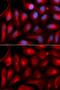 Proteasome subunit alpha type-5 antibody, GTX32817, GeneTex, Immunocytochemistry image 