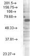 Potassium voltage-gated channel subfamily C member 4 antibody, GTX42014, GeneTex, Western Blot image 