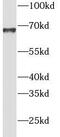 72 kDa inositol polyphosphate 5-phosphatase antibody, FNab04329, FineTest, Western Blot image 