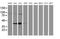 SPG7 Matrix AAA Peptidase Subunit, Paraplegin antibody, MA5-25907, Invitrogen Antibodies, Western Blot image 