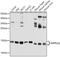Mitochondrial Ribosomal Protein L32 antibody, GTX64927, GeneTex, Western Blot image 