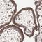 Autophagy Related 7 antibody, HPA007639, Atlas Antibodies, Immunohistochemistry paraffin image 