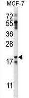 Neuritin 1 Like antibody, AP52938PU-N, Origene, Western Blot image 