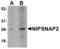 Nipsnap Homolog 2 antibody, LS-B3865, Lifespan Biosciences, Western Blot image 