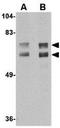 Junctophilin 2 antibody, GTX85364, GeneTex, Western Blot image 