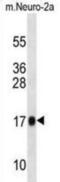 Ribosomal Protein L13a antibody, abx030929, Abbexa, Western Blot image 