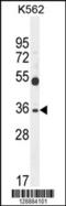 Sulfotransferase Family 1C Member 3 antibody, 55-605, ProSci, Western Blot image 