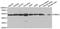 Proteasome 26S Subunit, ATPase 2 antibody, A1985, ABclonal Technology, Western Blot image 