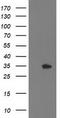 Haloacid Dehalogenase Like Hydrolase Domain Containing 2 antibody, TA503014, Origene, Western Blot image 