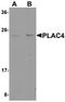 Placenta-specific protein 4 antibody, orb75512, Biorbyt, Western Blot image 