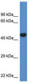 Phosphate Cytidylyltransferase 2, Ethanolamine antibody, TA335473, Origene, Western Blot image 