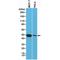 KRT18 antibody, M01357-3, Boster Biological Technology, Western Blot image 