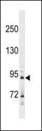 Hedgehog Interacting Protein antibody, 59-613, ProSci, Western Blot image 