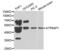 ATPase H+ Transporting Accessory Protein 1 antibody, abx001121, Abbexa, Western Blot image 