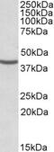 Solute Carrier Family 2 Member 5 antibody, 42-169, ProSci, Enzyme Linked Immunosorbent Assay image 