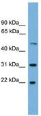 Crystallin Beta A4 antibody, TA340028, Origene, Western Blot image 