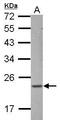 Zinc Finger Protein 22 antibody, GTX123643, GeneTex, Western Blot image 