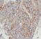 Annexin A7 antibody, FNab00439, FineTest, Immunohistochemistry paraffin image 