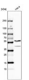 Terminal Nucleotidyltransferase 4A antibody, NBP2-13728, Novus Biologicals, Western Blot image 