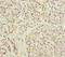Dermatopontin antibody, LS-C675655, Lifespan Biosciences, Immunohistochemistry paraffin image 