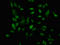 Interferon Regulatory Factor 2 Binding Protein 1 antibody, LS-C673358, Lifespan Biosciences, Immunofluorescence image 