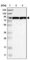Polypeptide N-Acetylgalactosaminyltransferase 8 antibody, PA5-52964, Invitrogen Antibodies, Western Blot image 