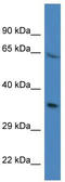 Proline Rich 16 antibody, TA345005, Origene, Western Blot image 