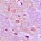 SS18 Subunit Of BAF Chromatin Remodeling Complex antibody, orb214615, Biorbyt, Immunohistochemistry paraffin image 