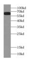 Mitogen-Activated Protein Kinase Kinase Kinase 2 antibody, FNab05119, FineTest, Western Blot image 