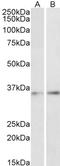 CCAAT Enhancer Binding Protein Beta antibody, LS-C186462, Lifespan Biosciences, Western Blot image 