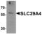 SLC29A4 antibody, PA5-72853, Invitrogen Antibodies, Western Blot image 