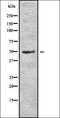 Lecithin-Cholesterol Acyltransferase antibody, orb337079, Biorbyt, Western Blot image 
