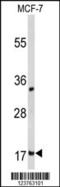 Destrin antibody, MBS9202049, MyBioSource, Western Blot image 