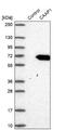 Caspase Activity And Apoptosis Inhibitor 1 antibody, NBP1-94020, Novus Biologicals, Western Blot image 