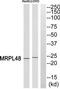 Mitochondrial Ribosomal Protein L48 antibody, TA315492, Origene, Western Blot image 