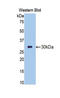 Chymotrypsin-like elastase family member 3B antibody, LS-C294130, Lifespan Biosciences, Western Blot image 