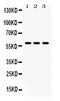 Protein Inhibitor Of Activated STAT 4 antibody, PB10082, Boster Biological Technology, Western Blot image 