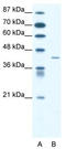 Somatostatin receptor type 4 antibody, TA333890, Origene, Western Blot image 