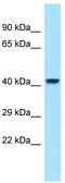 Peptidoglycan Recognition Protein 3 antibody, TA331282, Origene, Western Blot image 