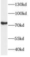 T-Box, Brain 1 antibody, FNab08529, FineTest, Western Blot image 