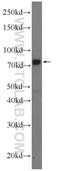 Methyl-CpG Binding Protein 2 antibody, 10861-1-AP, Proteintech Group, Western Blot image 