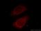 Telomere Maintenance 2 antibody, 66077-1-Ig, Proteintech Group, Immunofluorescence image 
