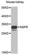 CD-MPR antibody, A6296, ABclonal Technology, Western Blot image 
