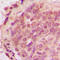 Ubiquitin B antibody, LS-C352974, Lifespan Biosciences, Immunohistochemistry paraffin image 