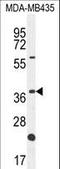 Olfactory Receptor Family 6 Subfamily V Member 1 antibody, LS-C163247, Lifespan Biosciences, Western Blot image 