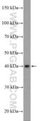 Zinc finger protein SNAI3 antibody, 21350-1-AP, Proteintech Group, Western Blot image 