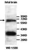 1-Aminocyclopropane-1-Carboxylate Synthase Homolog (Inactive) antibody, orb77709, Biorbyt, Western Blot image 