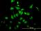 BRISC And BRCA1 A Complex Member 2 antibody, H00009577-B01P, Novus Biologicals, Immunocytochemistry image 