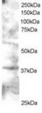 GRB2 Related Adaptor Protein 2 antibody, TA302501, Origene, Western Blot image 